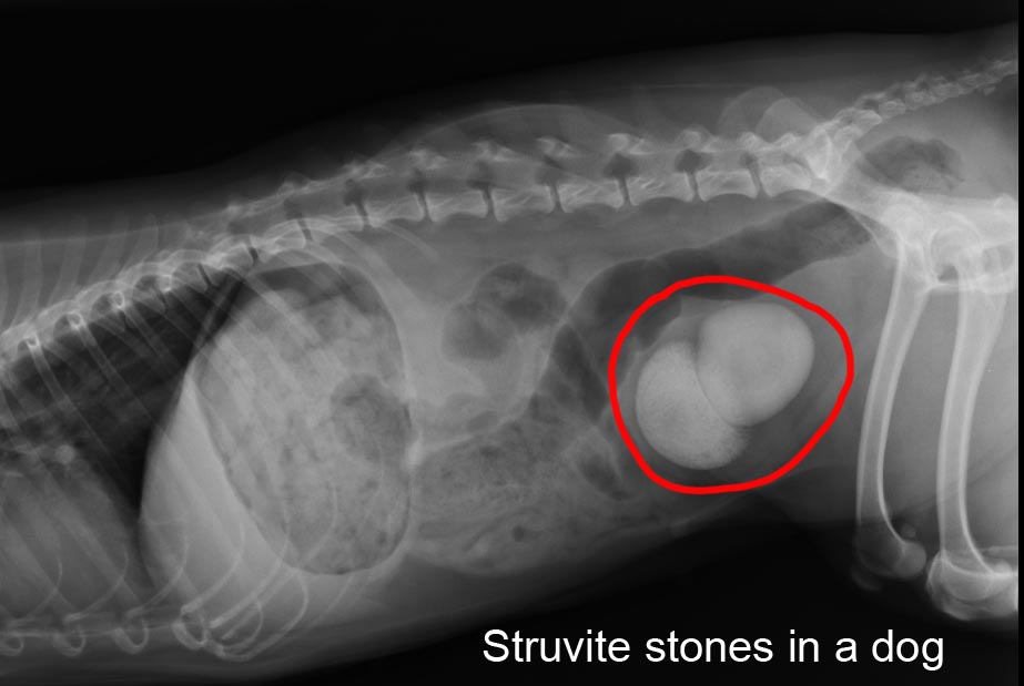 struvite kidney stones xray